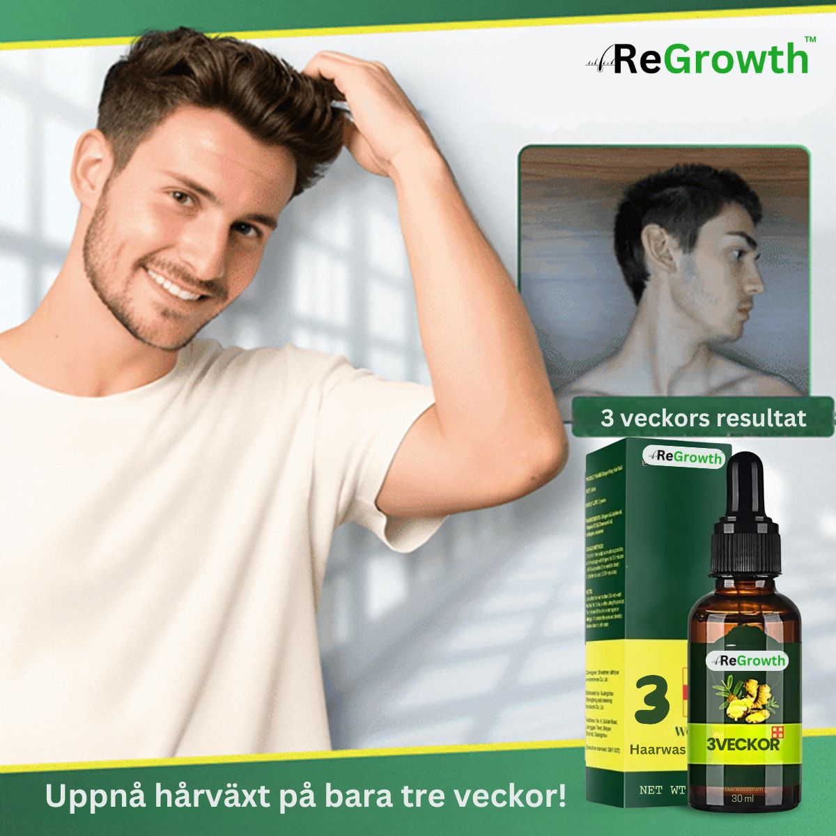 ReGrowth™️ Hair Serum | Längre hår på bara 3 veckor!